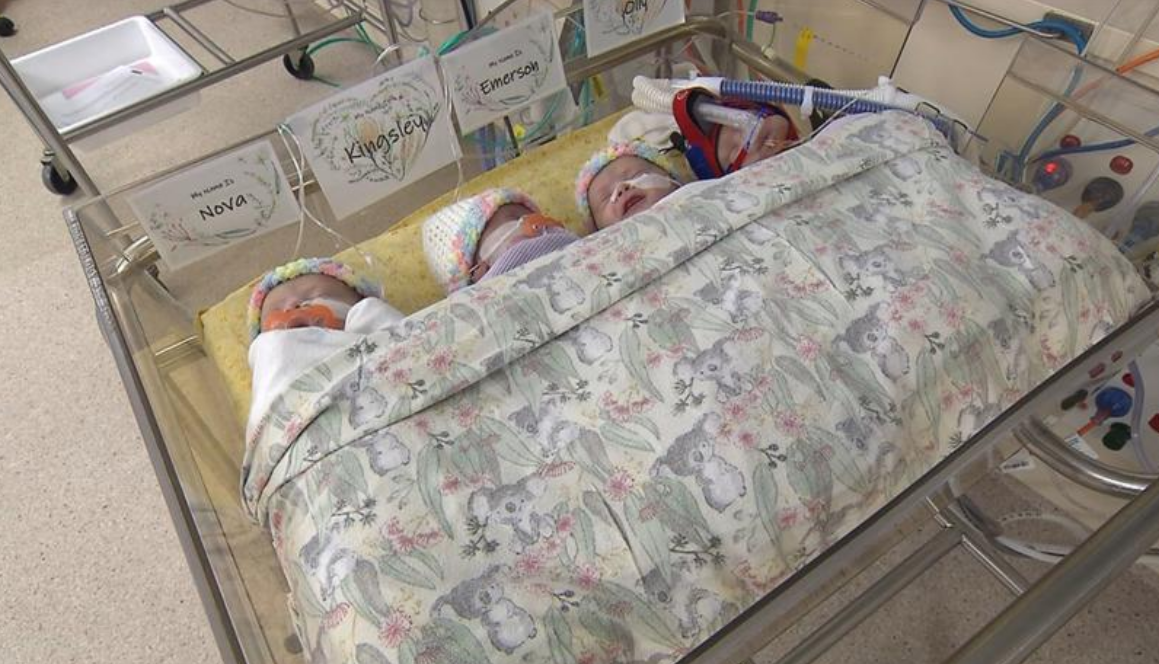 كوينزلاند ولادة نادرة تحدث كل 729000 حملاً في البلاد